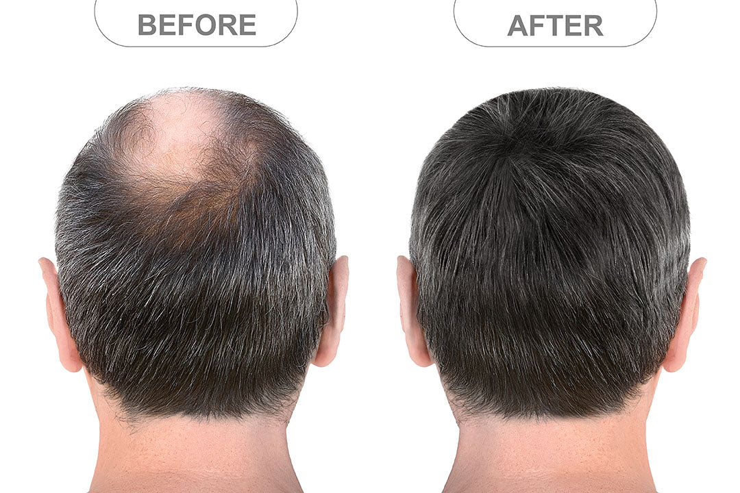 Hair Grow Helmet (HT03)